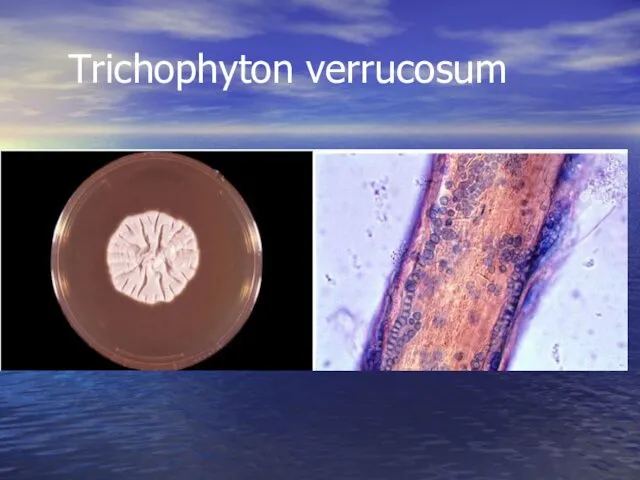 Trichophyton verrucosum