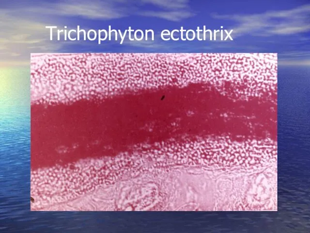 Trichophyton ectothrix