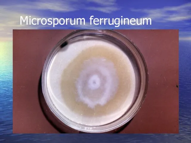 Microsporum ferrugineum