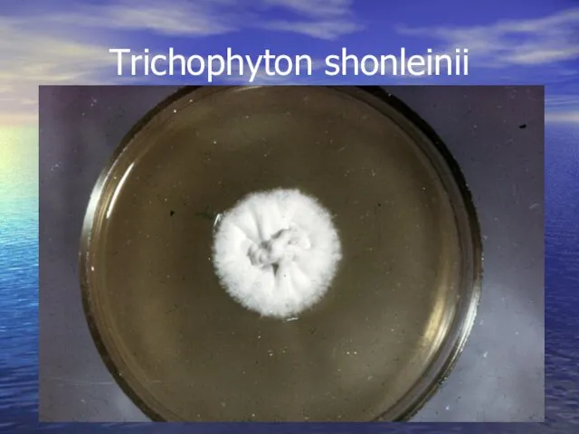 Тrichophyton shonleinii