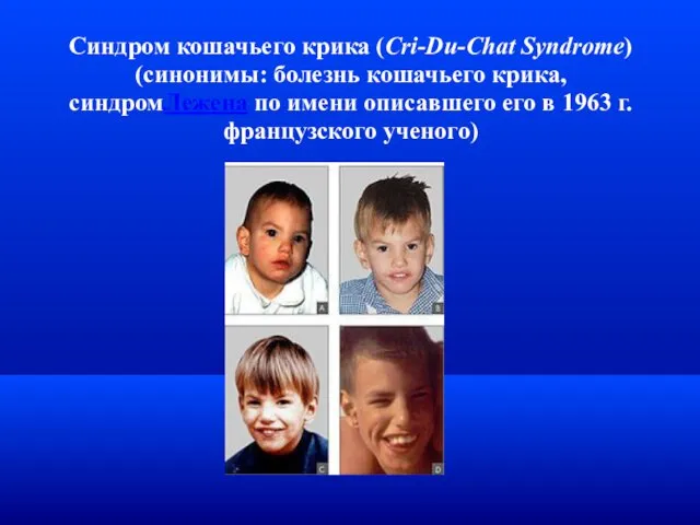 Синдром кошачьего крика (Cri-Du-Chat Syndrome) (синонимы: болезнь кошачьего крика, синдромЛежена по