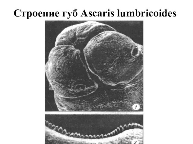 Строение губ Ascaris lumbricoides