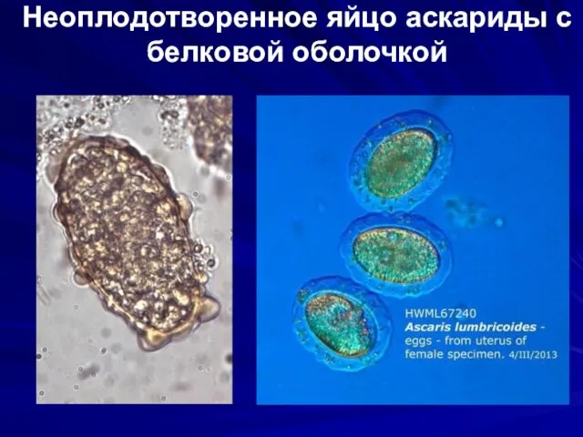 Неоплодотворенное яйцо аскариды с белковой оболочкой