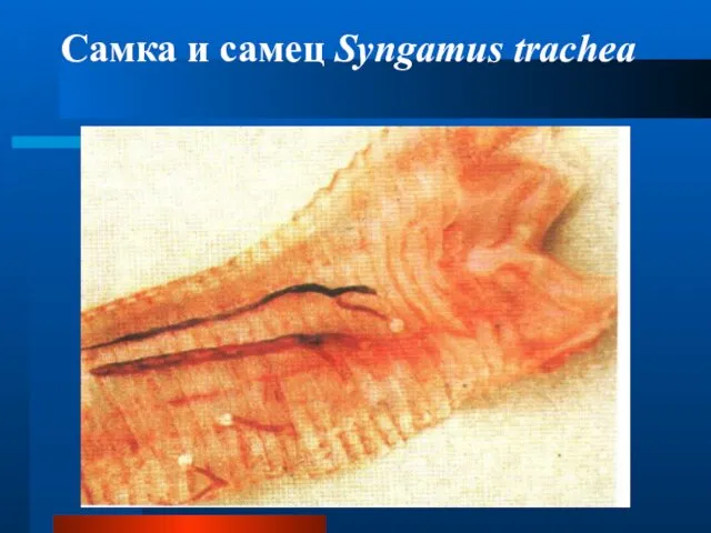 Самка и самец Syngamus trachea