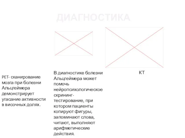 ДИАГНОСТИКА В диагностике болезни Альцгеймера может помочь нейропсихологическое скрининг-тестирование, при котором