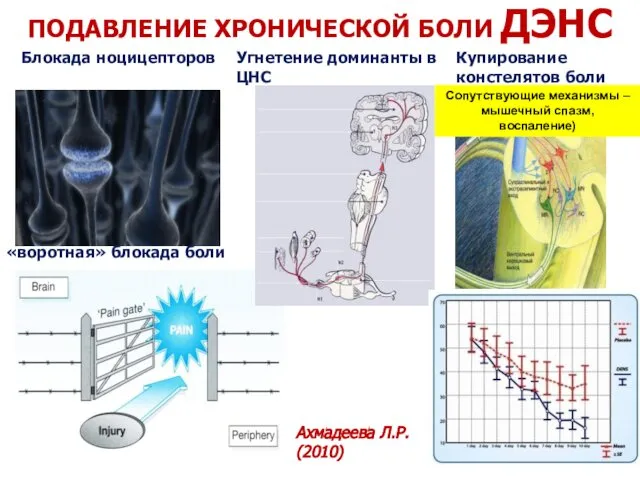 ПОДАВЛЕНИЕ ХРОНИЧЕСКОЙ БОЛИ ДЭНС Блокада ноцицепторов «воротная» блокада боли Угнетение доминанты