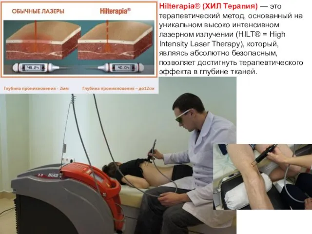 Hilterapia® (ХИЛ Терапия) — это терапевтический метод, основанный на уникальном высоко