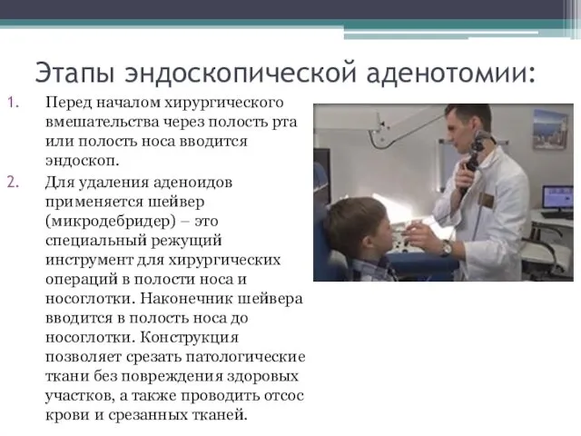 Этапы эндоскопической аденотомии: Перед началом хирургического вмешательства через полость рта или