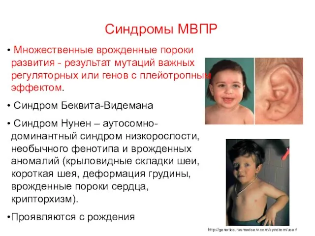 Синдромы МВПР http://genetics.rusmedserv.com/syndrom/user/ Множественные врожденные пороки развития - результат мутаций важных