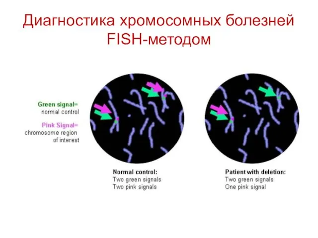 Диагностика хромосомных болезней FISH-методом