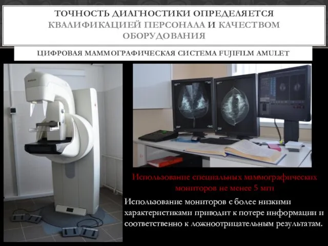 Использование специальных маммографических мониторов не менее 5 мгп Использование мониторов с