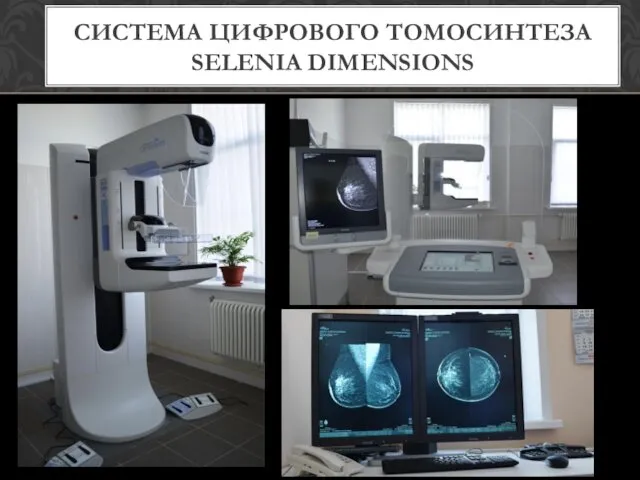 СИСТЕМА ЦИФРОВОГО ТОМОСИНТЕЗА SELENIA DIMENSIONS