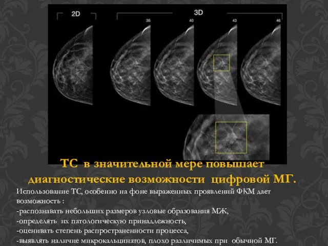 ТС в значительной мере повышает диагностические возможности цифровой МГ. Использование ТС,