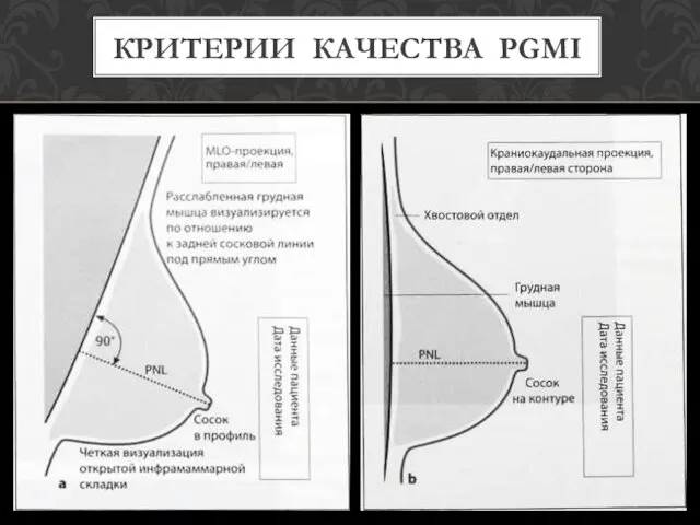 КРИТЕРИИ КАЧЕСТВА PGMI