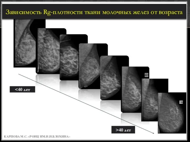 КАРПОВА М.С. «РОНЦ ИМ.Н.Н.БЛОХИНА» >50 лет Зависимость Rg-плотности ткани молочных желез от возраста >40 лет
