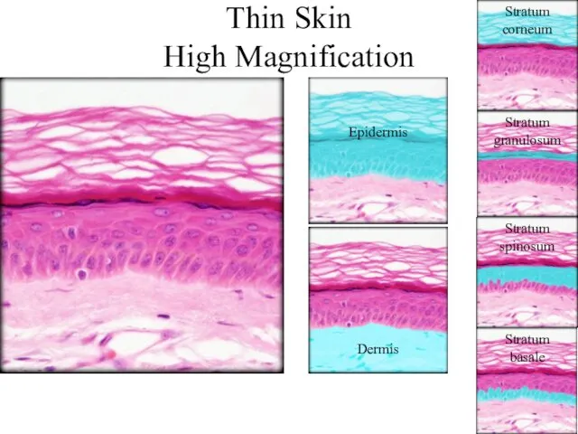 Thin Skin High Magnification Epidermis Dermis Stratum basale Stratum spinosum Stratum granulosum Stratum corneum