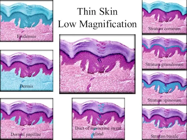 Thin Skin Low Magnification Epidermis Dermis Dermal papillae Duct of merocrine