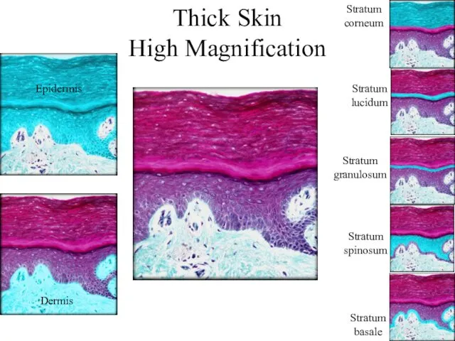 Thick Skin High Magnification Epidermis Dermis Stratum basale Stratum spinosum Stratum granulosum Stratum lucidum Stratum corneum