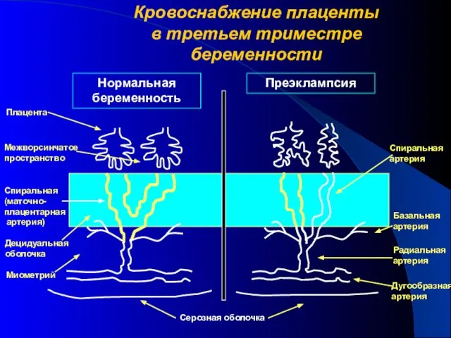 Кровоснабжение плаценты в третьем триместре беременности Нормальная беременность Преэклампсия Плацента Межворсинчатое