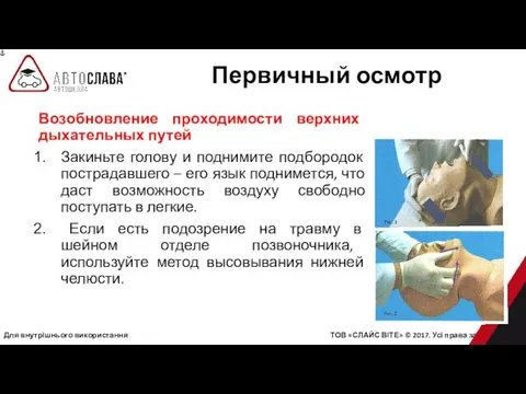 Для внутрішнього використання ТОВ «СЛАЙС ВІТЕ» © 2017. Усі права захищені.