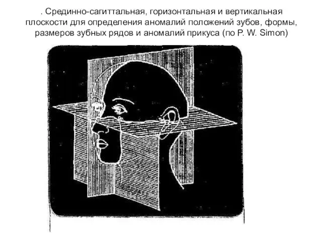 . Срединно-сагиттальная, го­ризонтальная и вертикальная плоскости для определения аномалий положений зубов,