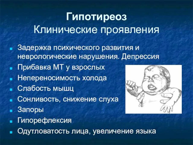 Гипотиреоз Клинические проявления Задержка психического развития и неврологические нарушения. Депрессия Прибавка