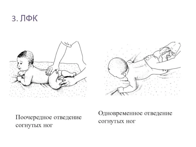 3. ЛФК Поочередное отведение согнутых ног Одновременное отведение согнутых ног