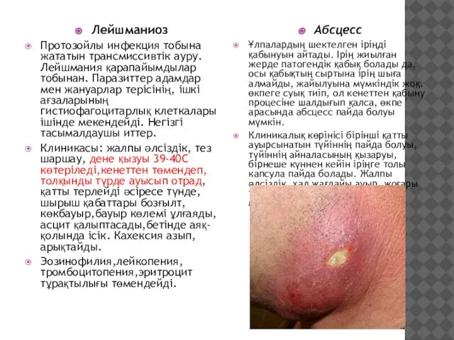 Лейшманиоз Протозойлы инфекция тобына жататын трансмиссивтік ауру. Лейшмания қарапайымдылар тобынан. Паразиттер
