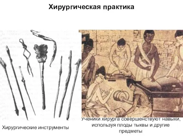 Хирургическая практика Хирургические инструменты Ученики хирурга совершенствуют навыки, используя плоды тыквы и другие предметы