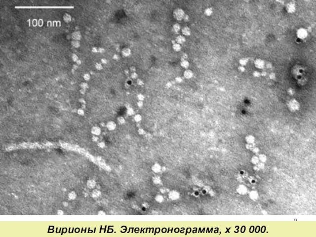 Вирионы НБ. Электронограмма, х 30 000.