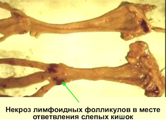 Некроз лимфоидных фолликулов в месте ответвления слепых кишок