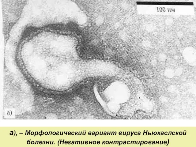 а), – Морфологический вариант вируса Ньюкаслской болезни. (Негативное контрастирование)