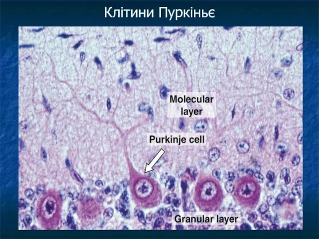 Клітини Пуркіньє