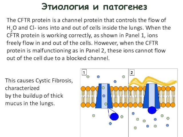 Этиология и патогенез The CFTR protein is a channel protein that