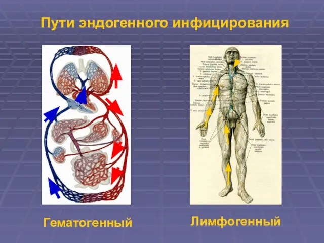 Пути эндогенного инфицирования Гематогенный Лимфогенный