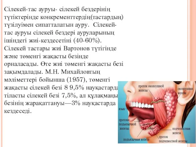 Сілекей-тас ауруы- сілекей бездерінің түтіктерінде конкременттердің(тастардың) түзілуімен сипатталатын ауру. Сілекей-тас ауруы