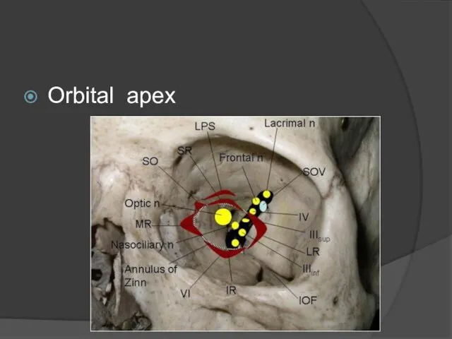 Orbital apex