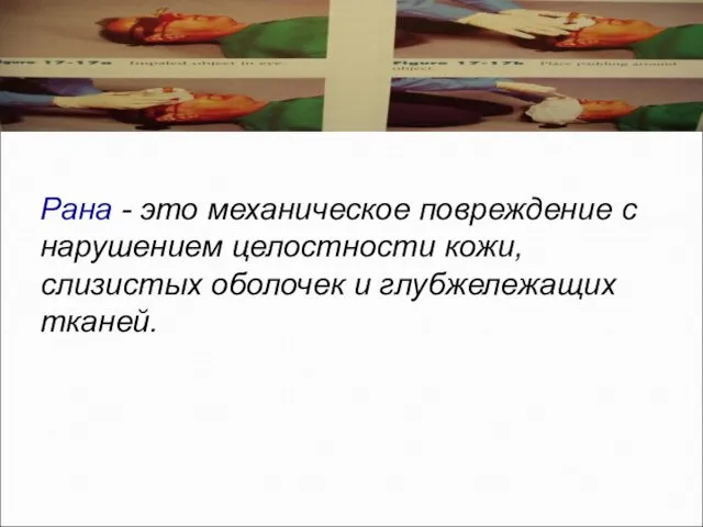 Раны Рана - это механическое повреждение с нарушением целостности кожи, слизистых оболочек и глубжележащих тканей.