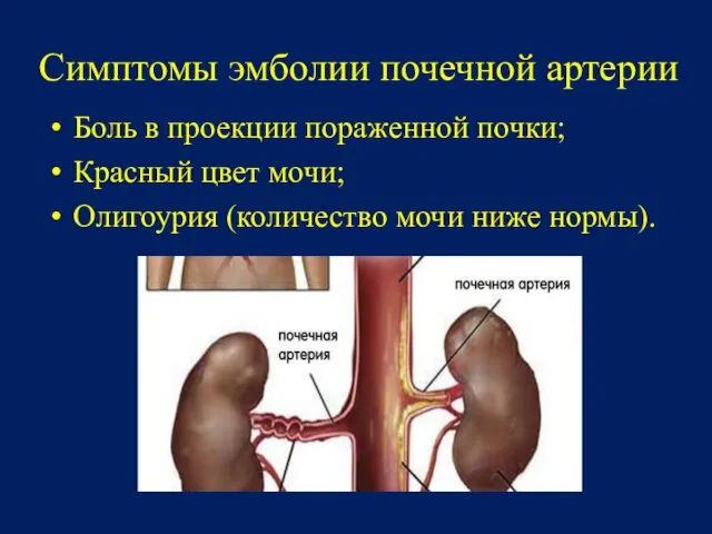 Симптомы эмболии почечной артерии Боль в проекции пораженной почки; Красный цвет