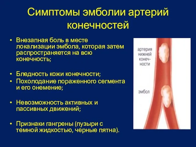 Симптомы эмболии артерий конечностей Внезапная боль в месте локализации эмбола, которая