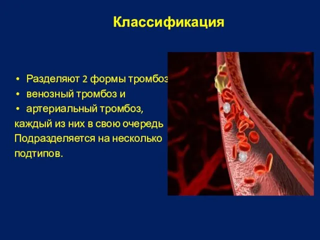 Классификация Разделяют 2 формы тромбоза: венозный тромбоз и артериальный тромбоз, каждый
