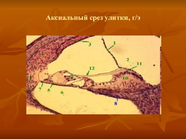 Аксиальный срез улитки, г/э