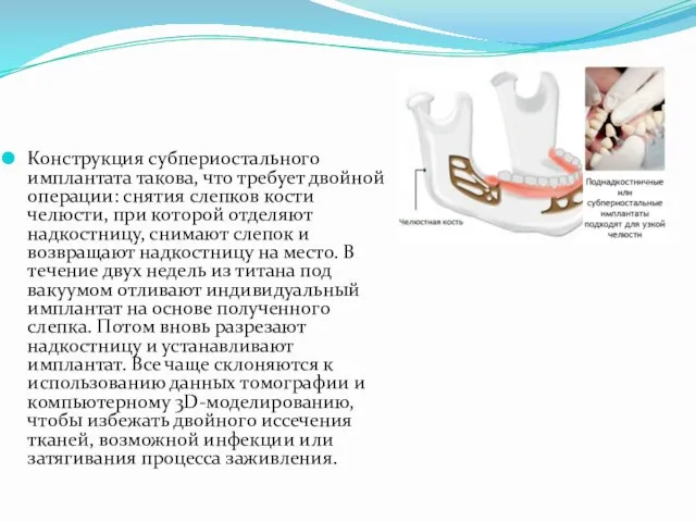 Конструкция субпериостального имплантата такова, что требует двойной операции: снятия слепков кости