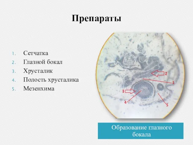 Препараты Образование глазного бокала Сетчатка Глазной бокал Хрусталик Полость хрусталика Мезенхима