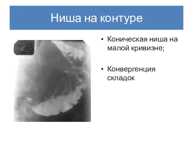 Ниша на контуре Коническая ниша на малой кривизне; Конвергенция складок