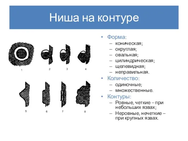 Ниша на контуре Форма: коническая; округлая; овальная; цилиндрическая; щелевидная; неправильная. Количество: