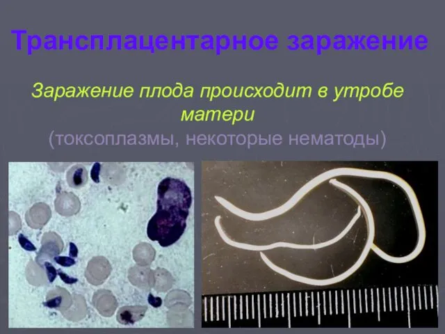 Трансплацентарное заражение Заражение плода происходит в утробе матери (токсоплазмы, некоторые нематоды)