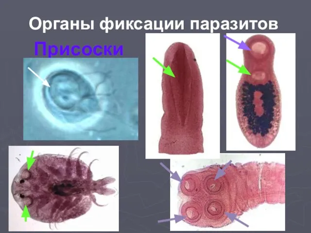 Органы фиксации паразитов Присоски