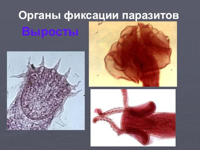 Органы фиксации паразитов Выросты