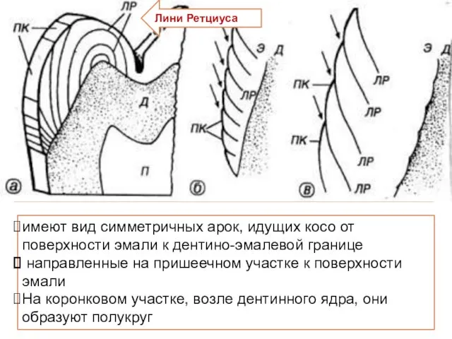 Полосы Ретциуса можно различить под световым микроскопом. Они образуются в результате